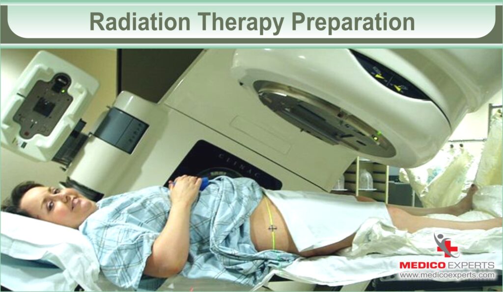 Radiation Therapy Preparation