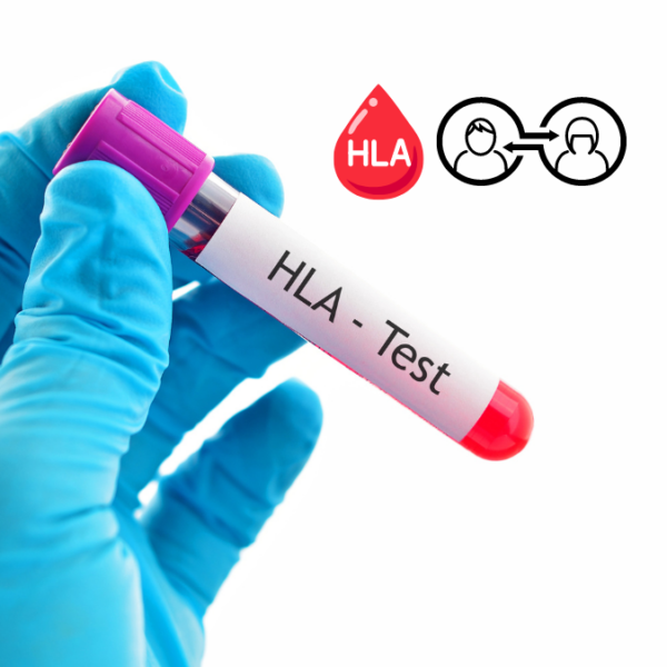 HLA Matching Test for Stem cell transplant