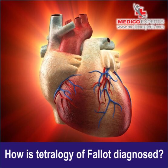 Heart Tetralogy of Fallot Treatment WEB PIX 7 How is tetralogy of Fallot diagnosed?