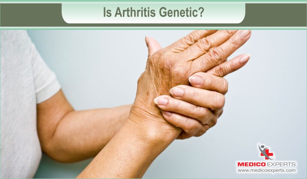 Is Arthritis Genetic?
