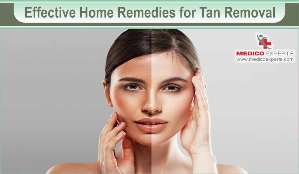 Effective Home Remedies for Tan Removal