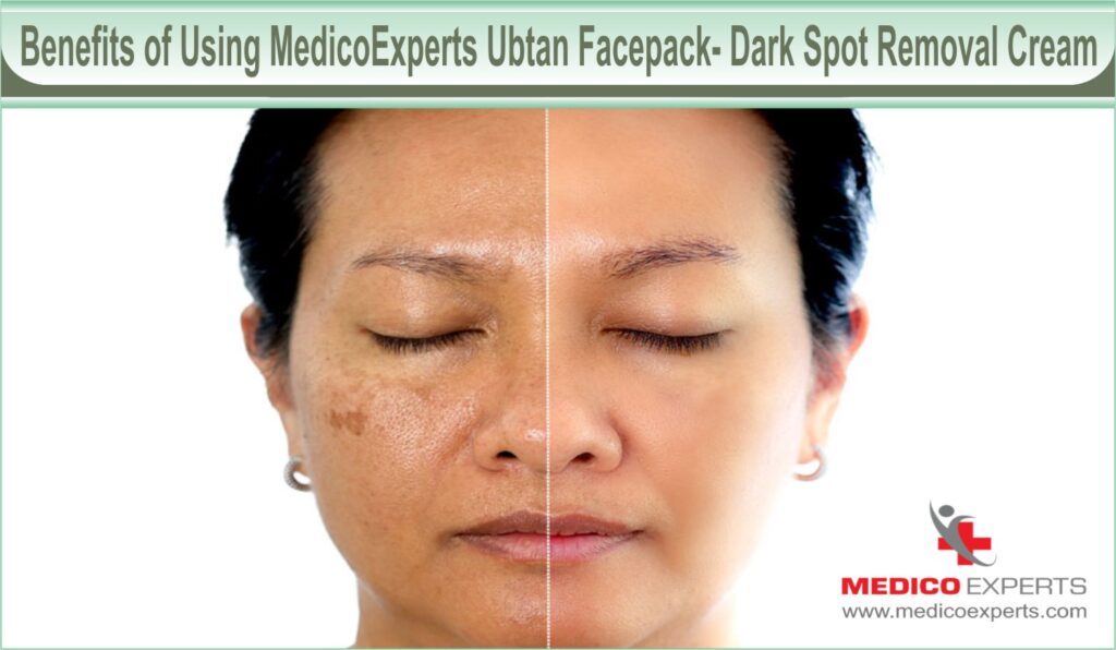 Benefits of Using MedicoExperts Ubtan Facepack- Dark Spot Removal Cream