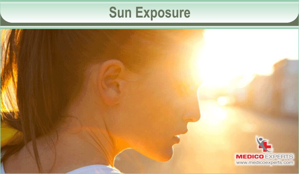 Sun Exposure