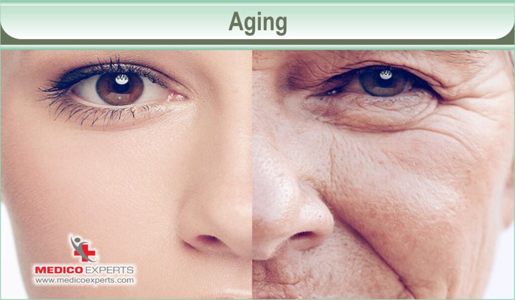 Aging