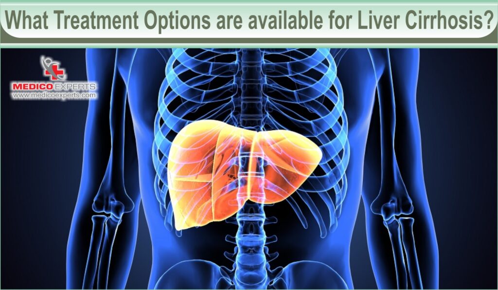 What Treatment Options are available for Liver Cirrhosis?