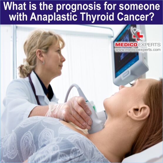 Anaplastic Thyroid PIX 9 Cancer WEB 9 What is the prognosis for someone with Anaplastic Thyroid Cancer?