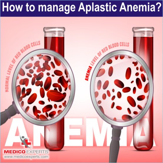 Aplastic Anemia WEB Photo Artwork 7 How to manage Aplastic Anemia?