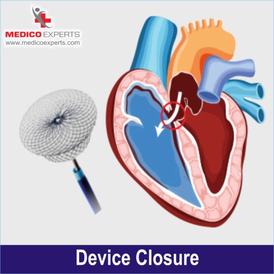 Device Closure