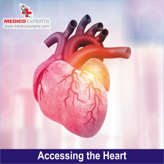 Accessing the Heart