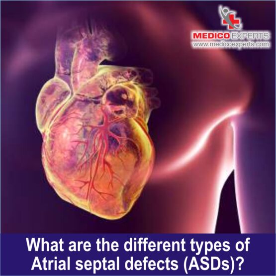 What are the different types of Atrial Septal Defects (ASDs)?