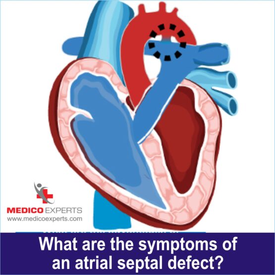 What are the symptoms of an Atrial Septal Defect?