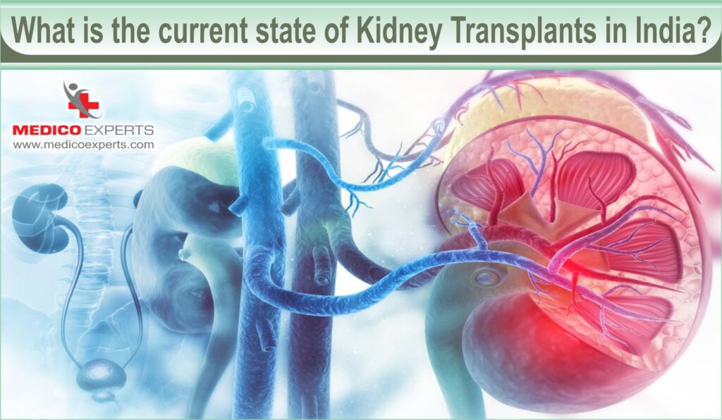 What is the current state of kidney transplants in India?