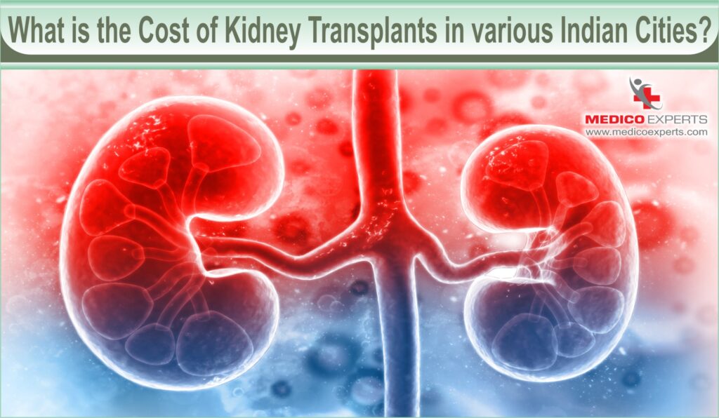 What is the cost of kidney transplants in various Indian cities?