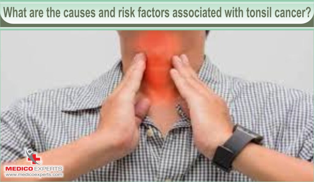 What are the causes and risk factors associated with tonsil cancer?