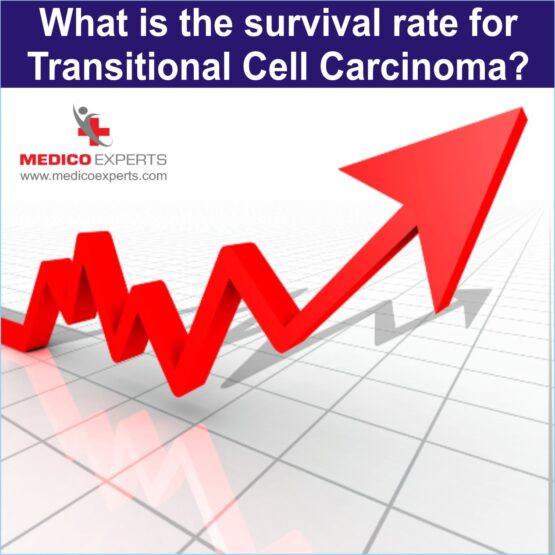 Transitional Cell Carcinoma WEB Photo 12 What is the survival rate for Transitional Cell Carcinoma?
