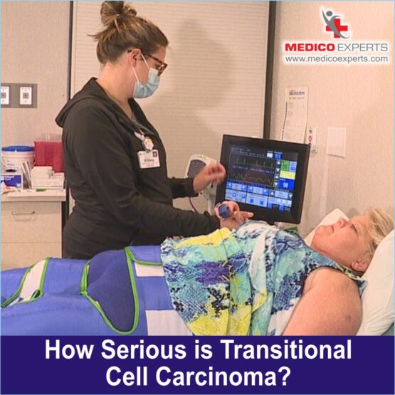 Transitional Cell Carcinoma WEB Photo 5 (1) How serious is Transitional Cell Carcinoma?