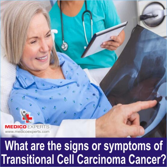 Transitional Cell Carcinoma WEB Photo 8 What are the signs or symptoms of Transitional Cell Carcinoma Cancer?