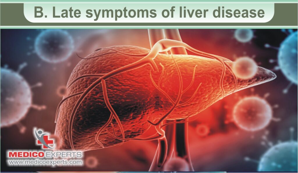 Late symptoms of liver disease