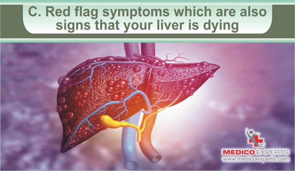 Red flag symptoms which are also signs that your liver is dying