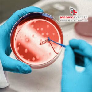 Are you eligible for stem cell therapy?