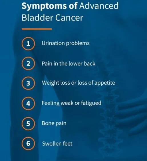 What are the signs and symptoms of bladder cancer signs and symptoms of bladder cancer, Where does bladder cancer usually spread first?, How fast does bladder cancer spread?