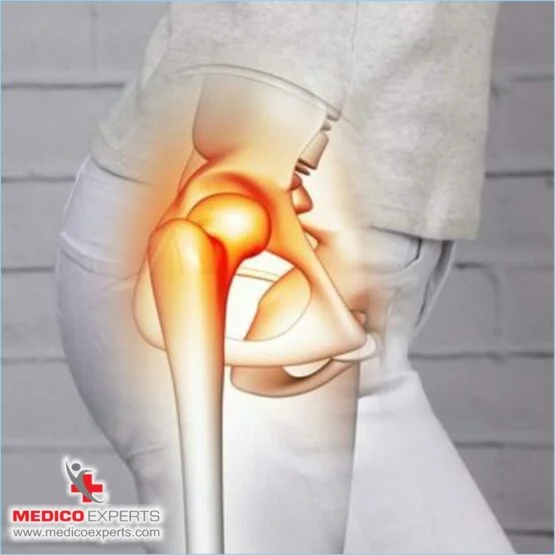 avascular necrosis treatment in india avascular necrosis treatment in india, How is Avascular Necrosis diagnosed?