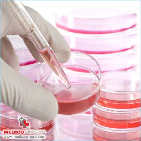stem cell therapy for avn in india. stem cell therapy for avn in india, What are the potential benefits of stem cell therapy?