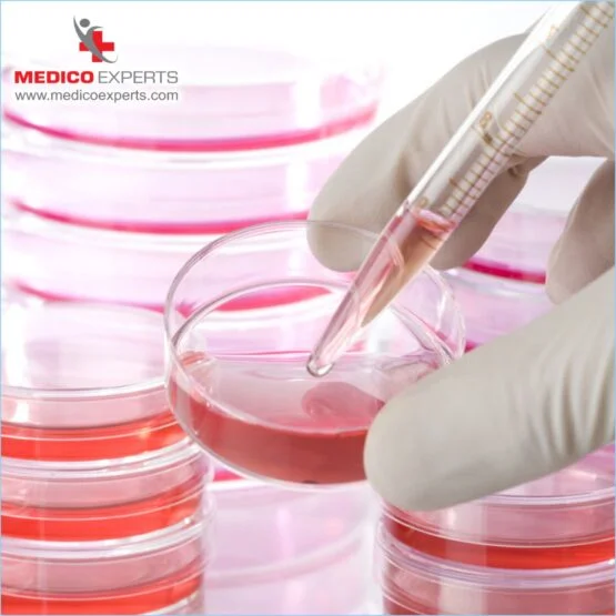 stem cell therapy for cerebral palsy, stem cell treatment for cerebral palsy in india