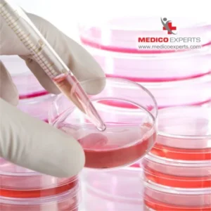 stem cell treatment in india Why should you opt for stem cell therapy in India?