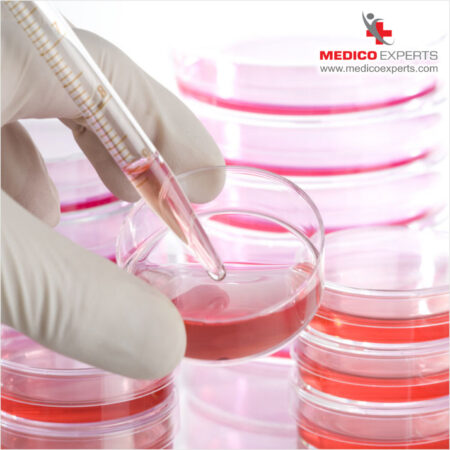 How Stem Cell Therapy for Muscular Dystrophy in India Changing Lives