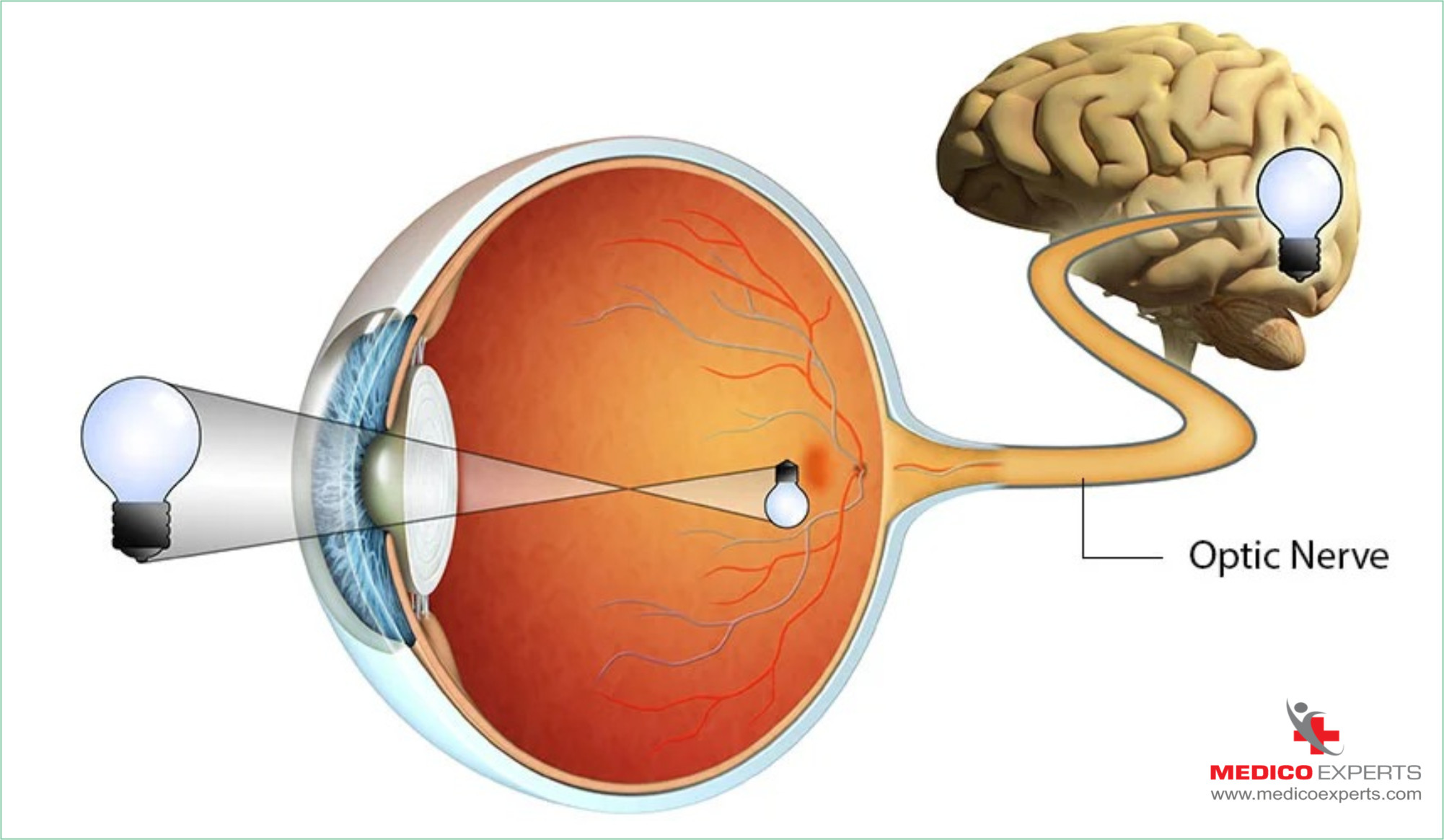 symptoms of optic nerve damage | MedicoExperts