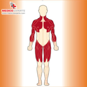 What is Muscular Dystrophy?, Muscle Degeneration, Genetic Muscle Disorders