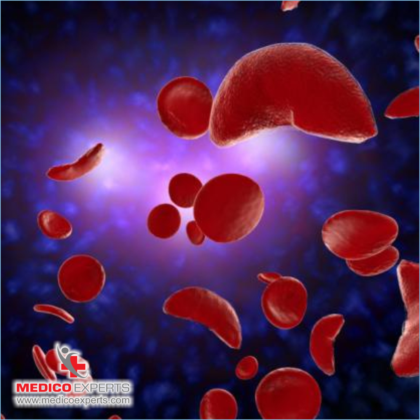 How to choose the Best Hemato-Oncologist for the Treatment?