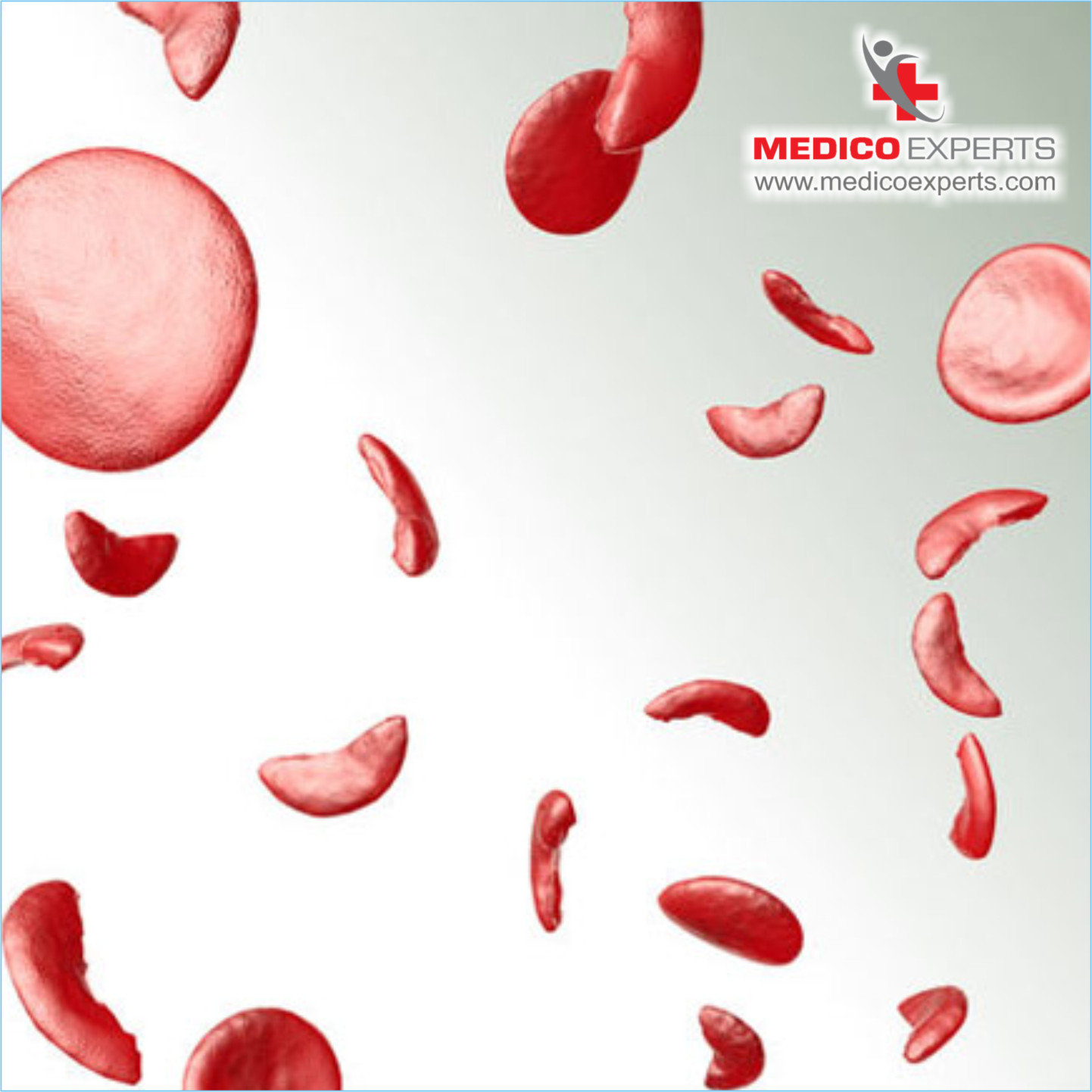 What are the Complications of Multiple Myeloma?