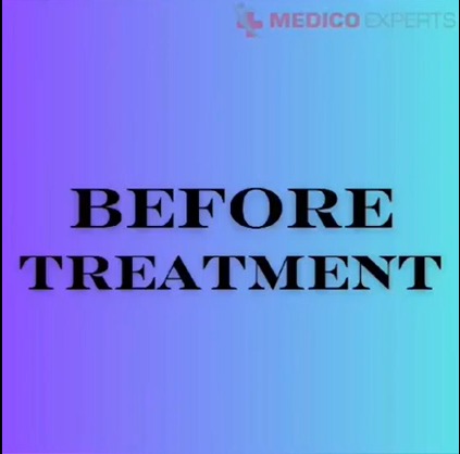 | MedicoExperts
