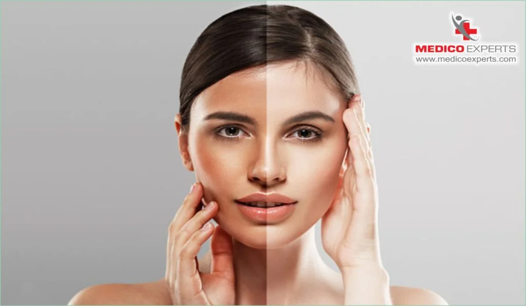 Manjistha: The Natural Detox for Healthier, Glowing Skin ? 8 Manjistha for skin detox