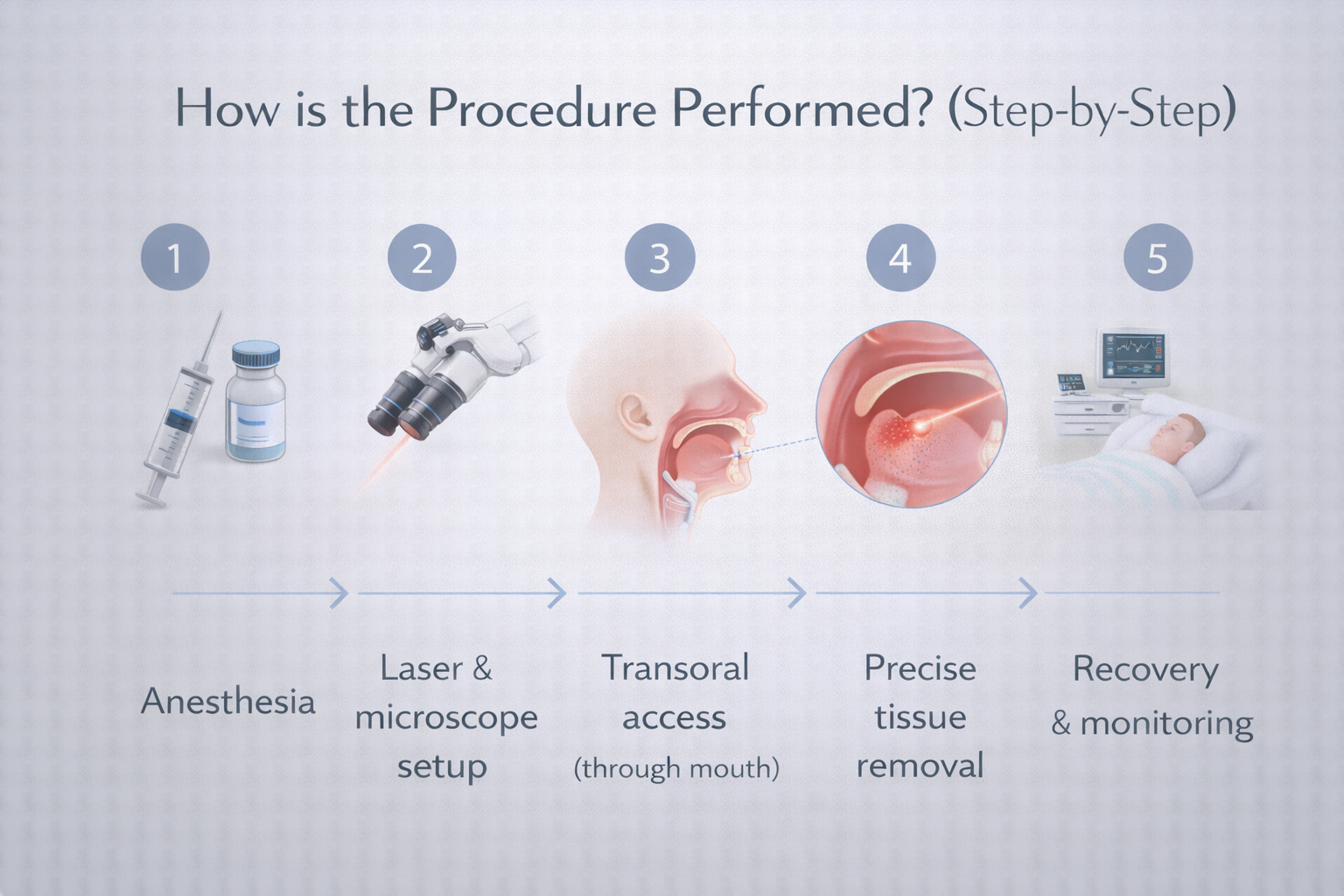 Transoral Laser Microsurgery (TLM): Uses, Benefits, Risks & Recovery 10 How is the Procedure Performed? (Step-by-Step)