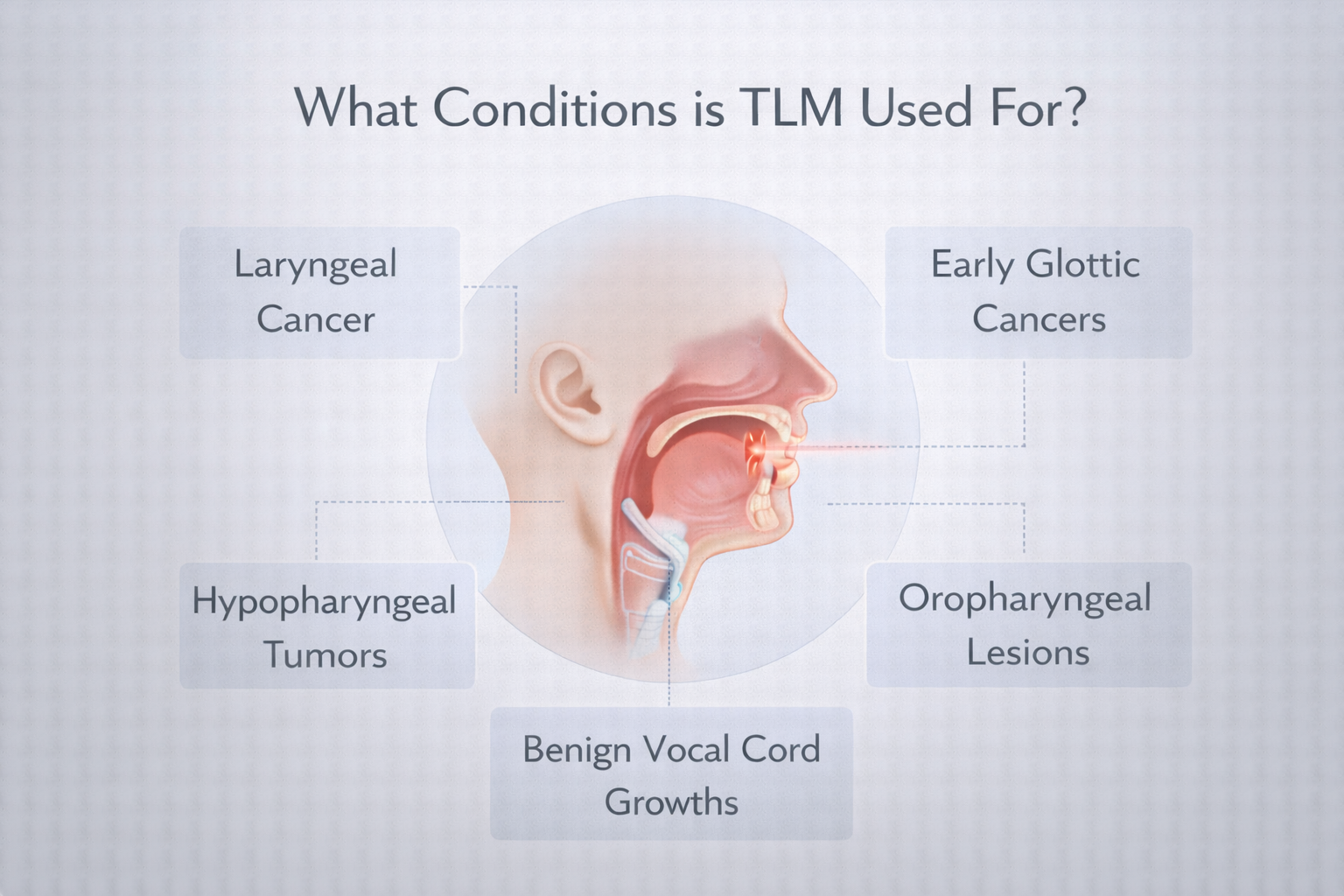 Transoral Laser Microsurgery (TLM): Uses, Benefits, Risks & Recovery 9 What Conditions is TLM Used For?