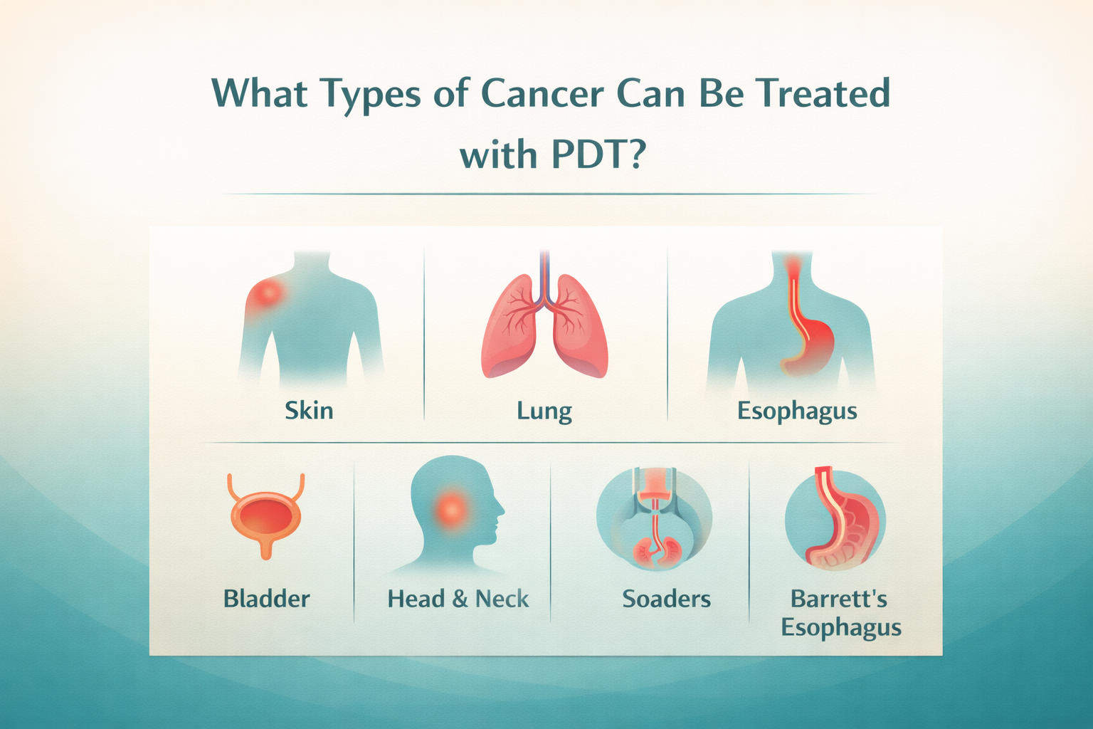 Photodynamic Therapy For Cancer Treatment: How It Works, Benefits, Side Effects & Success Rates 9 What Types of Cancer Can Be Treated with PDT?