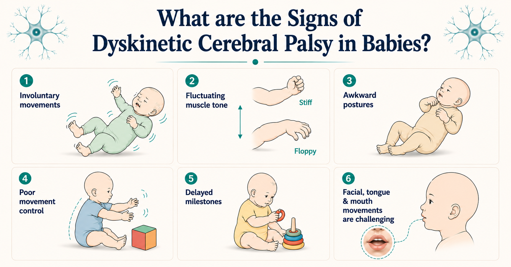 Signs Of Dyskinetic Cerebral Palsy In Babies Parents Should Not Ignore 9 What are the Signs of Dyskinetic Cerebral Palsy in Babies?